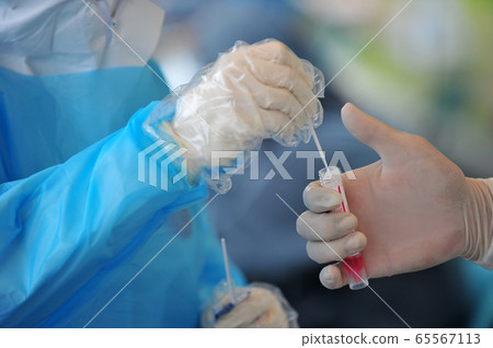 Corona 19 diagnostic test 65567113