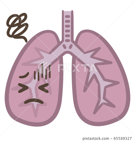 Lung disease 65589327