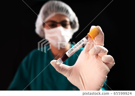 Blood Sample in a flask for analyzing Corona virus and producing vaccine. Corona virus outbreaking.  65599924