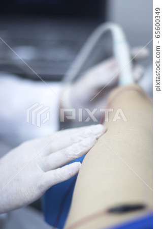 EPI dry needling ultrasound scan EPI dry needling ultrasound scan 65600349