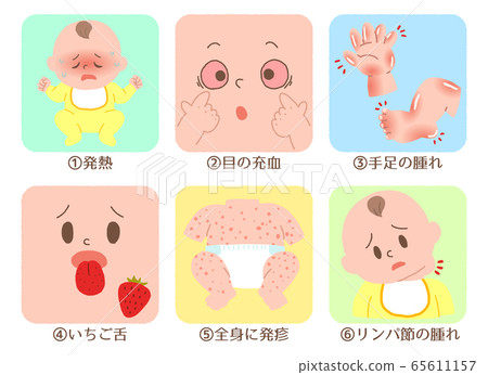 Baby Kawasaki disease symptom set 65611157