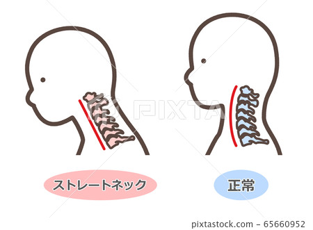 Straight neck smartphone neck, etc. 65660952