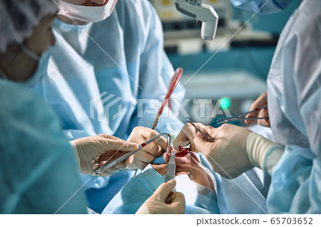 A surgeon with gloves is operating on his nose. Rhinoplasty, close-up operation. Blue light, teamwork, health, beauty. A surgeon with gloves is operating on his nose. Rhinoplasty, close-up operation. Blue light, teamwork, health, beauty. 65703652