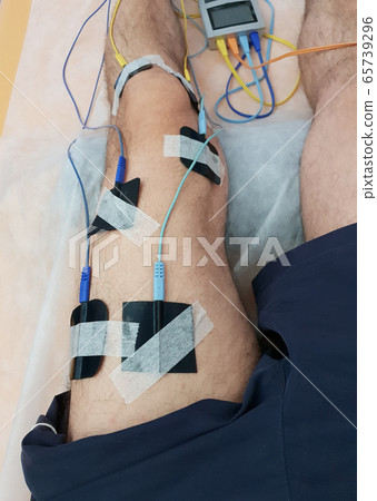 Electrostimulation of the quadriceps as a 65739296