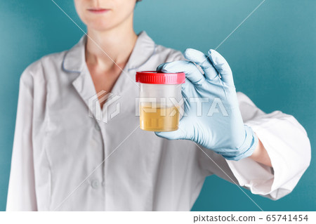yellow urine in a plastic test jar in the hand of 65741454