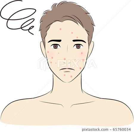 Men acne beauty 65760034