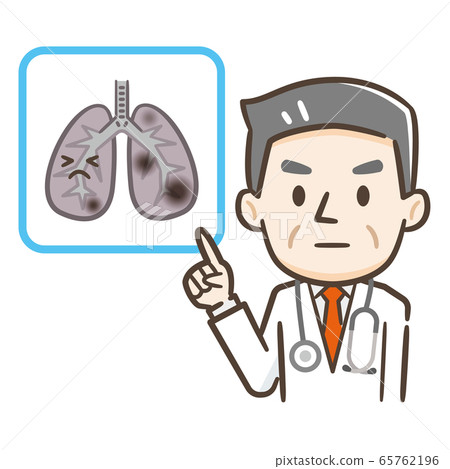 肺癌醫生 65762196