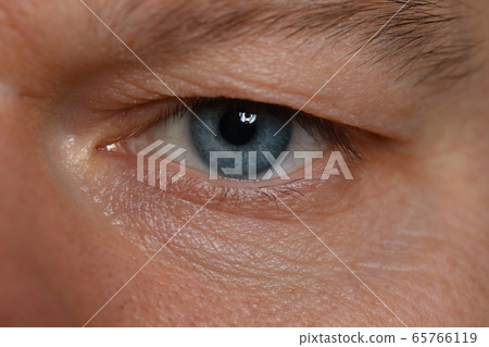 Close-up unkind angry look man, eye young man 65766119