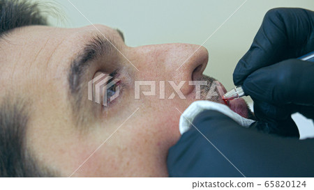 High quality close-up of a man laying on a couch during the esthetician lips treatment. Male permanent make-up service. High quality close-up of a man laying on a couch during the esthetician lips treatment. Male permanent make-up service. 65820124