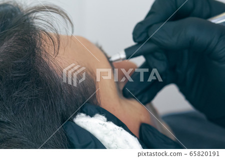 Close up of cosmetologist making permanent makeup. Microblading procedure. High quality close-up of a man laying on a couch during the esthetician brow microblading treatment. Close up of cosmetologist making permanent makeup. Microblading procedure. High quality close-up of a man laying on a couch during the esthetician brow microblading treatment. 65820191
