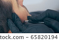 High quality close-up of a man laying on a couch during the esthetician hair treatment. Male tricopigmentation service. Scalp micropigmentation treatment. Trichopigmentation procedure. 65820194