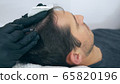 High quality close-up of a man laying on a couch during the esthetician hair treatment. Male tricopigmentation service. Scalp micropigmentation treatment. Trichopigmentation procedure. 65820196