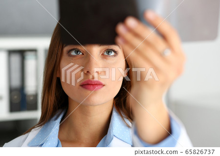 Beautiful female doctor hold in arm xray picture Beautiful female doctor hold in arm xray picture 65826737