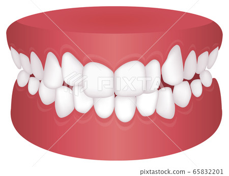 Types of dentition, dentition, malocclusion Vector illustration / crowd (random pile teeth) 65832201