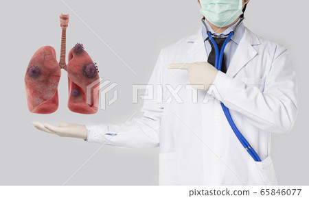 doctor holding lung that has virus COVID-19 infection 65846077
