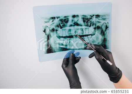 Doctor examining teeth x-ray image, close up Doctor examining teeth x-ray image, close up 65855231