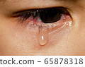 .The child is crying. 65878318