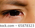 .The child is crying. 65878323