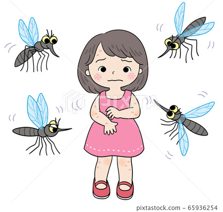 Female mosquito bites, swelling of the skin, swelling of the hand, circadian mosquito 65936254