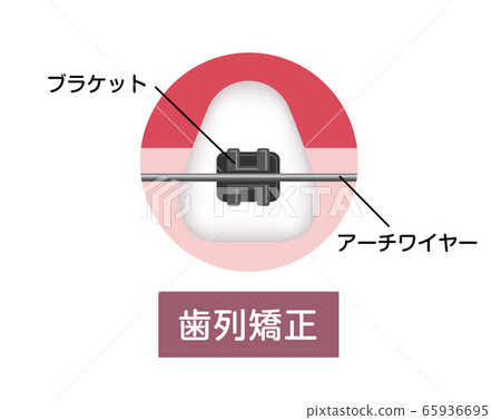 Orthodontics, orthodontics, vector illustration Orthodontics, orthodontics, vector illustration 65936695