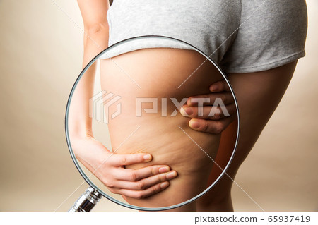 用放大鏡放大女人大腿的脂肪 用放大鏡放大女人大腿的脂肪 65937419
