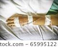 The hand of a patient in hospital 65995122