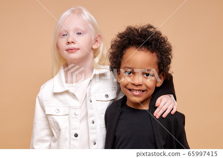 two friendly african and albino children stand together two friendly african and albino children stand together 65997415