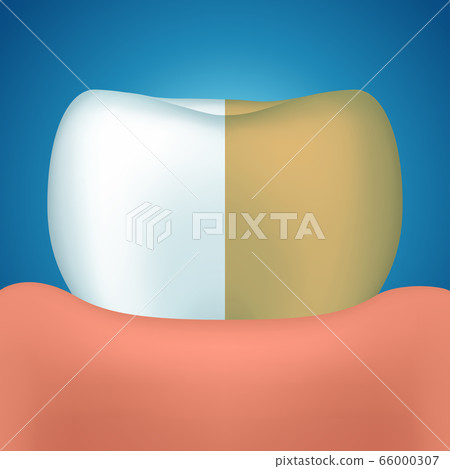 tooth on blue tooth on blue 66000307