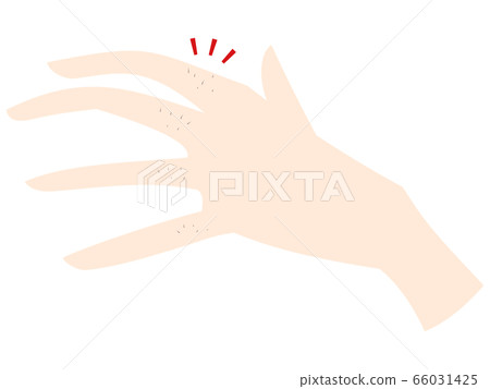 Useless hair on fingers Useless hair on fingers 66031425