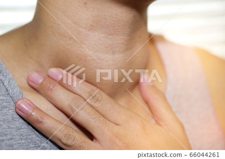 Asian lady patient have abnormal enlargement of thyroid gland Hyperthyroidism at the throat Asian lady patient have abnormal enlargement of thyroid gland Hyperthyroidism at the throat 66044261