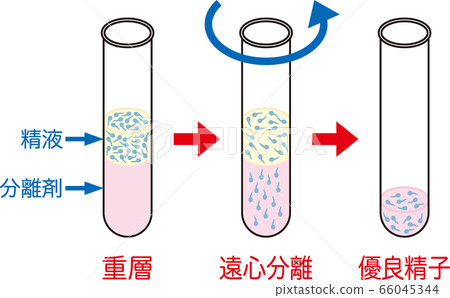 人工授精_密度梯度離心 66045344
