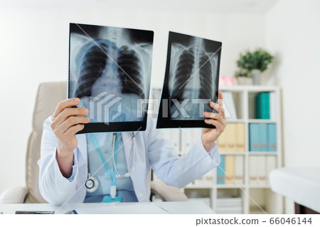 Doctor comparing lungs x-rays 66046144