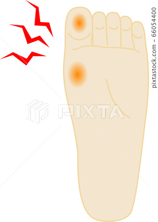 Octopus hurt foot illustration Octopus hurt foot illustration 66054400