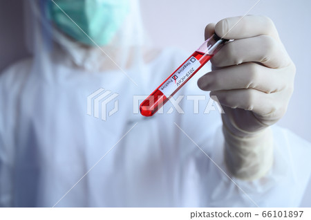 Scientist doctor holding a sample test tube with blood for 2019-nCoV analyzing. Conceptual of laboratory testing for the respiratory coronavirus disease 2019 (COVID-19). 66101897
