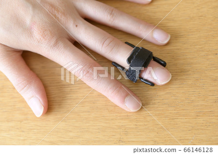 Treatment of mallet deformation (spring type fixed brace) 66146128