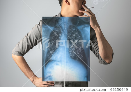 A Man smoking dangerous cigarette with x-ray lung. 66150449