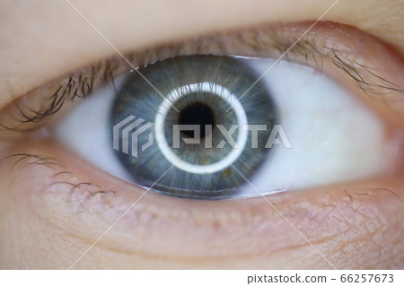 Laser correction vision concept 66257673