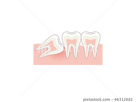 Tooth Tooth 66312682