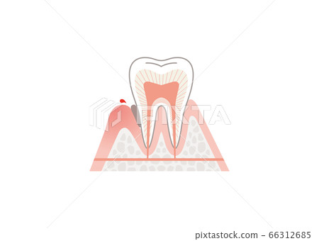 Tooth 66312685