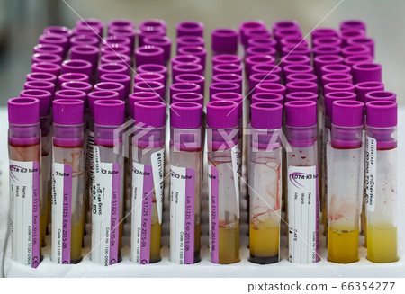 Blood tube for testing in laboratory Blood tube for testing in laboratory 66354277