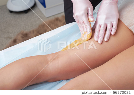 The beautician is preparing for depilation and applying the liquid sugar on the female legs. 66370021