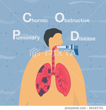 Spirometry is a test used to measure lung function. Chronic obstructive pulmonary disease causes breathing problems and poor airflow. Pulmonology vector illustration. Spirometry is a test used to measure lung function. Chronic obstructive pulmonary disease causes breathing problems and poor airflow. Pulmonology vector illustration. 66385781