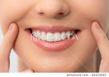 Teeth whitening, perfect smile 66428985