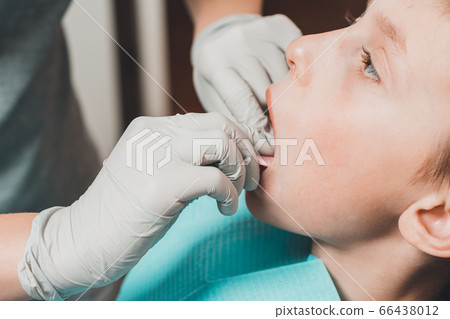 The boy orthodontist makes a fitting for the plate. 66438012