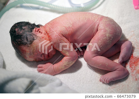Close-up of newborn asian chinese baby right after Close-up of newborn asian chinese baby right after 66473079