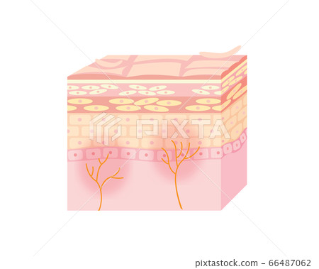 皮膚炎或皮膚粗糙的皮膚 皮膚炎或皮膚粗糙的皮膚 66487062