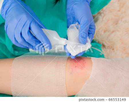 The doctor's hands in sterile gloves are treated with an antiseptic bandage to bind an abrasion on the knee of a teenage girl. The doctor's hands in sterile gloves are treated with an antiseptic bandage to bind an abrasion on the knee of a teenage girl. 66553149