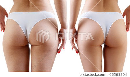 Female buttocks before and after retouch. 66565204