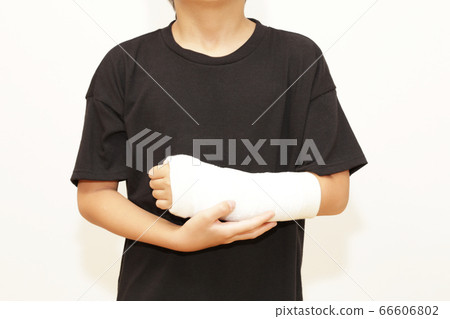 Fracture of arm, cast fixed Fracture of arm, cast fixed 66606802