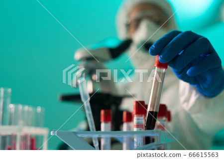 Checking blood for coronavirus antibodies Checking blood for coronavirus antibodies 66615563